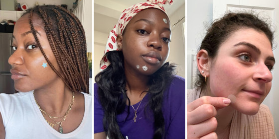 We tried several different acne spot treatments, including gels, pimple patches and creams, so you don’t have to.