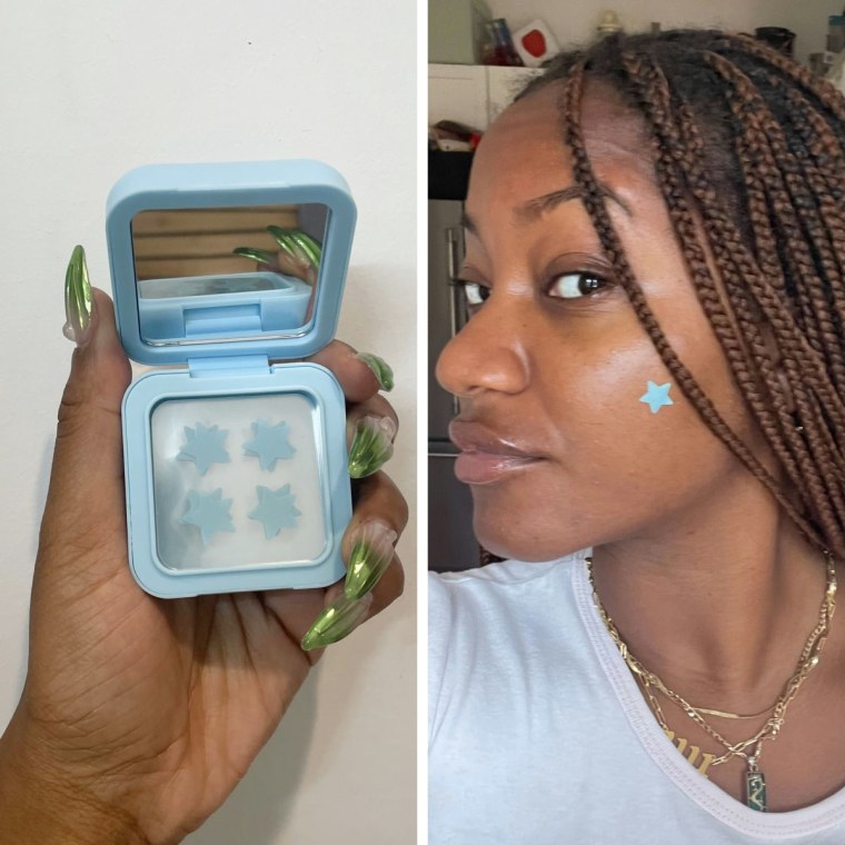 NBC Select associate SEO reporter Ashley Morris targets stubborn acne spots with Starface's Hydro Star + Salicylic Acid Pimple Patches.